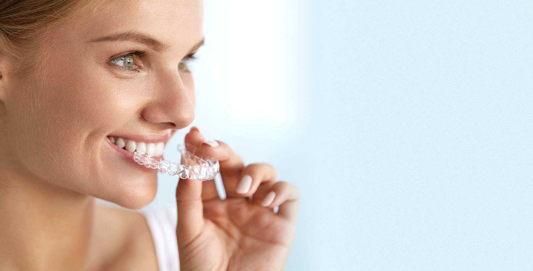 30% Off Invisible Braces Treatment